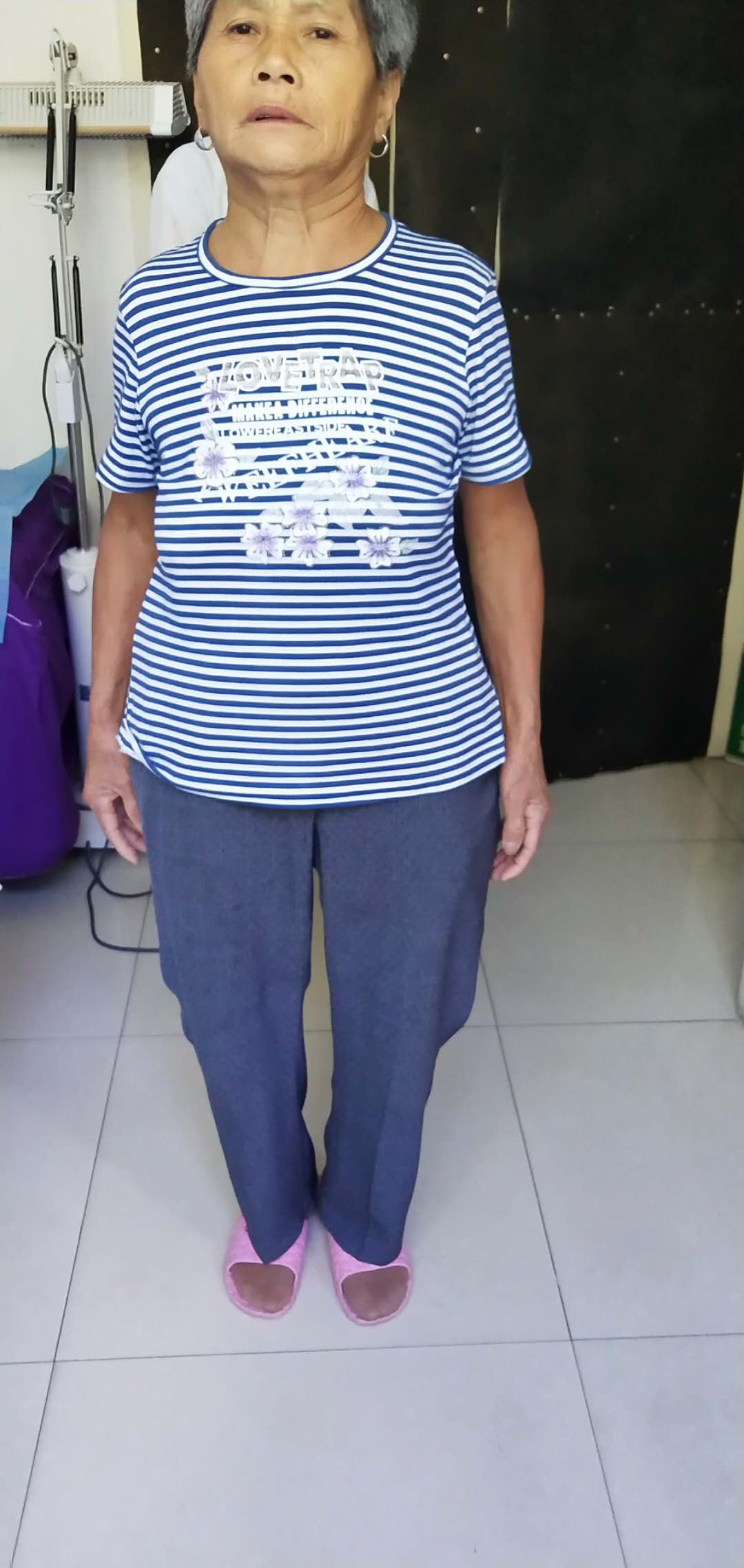 小针刀治疗后.jpg