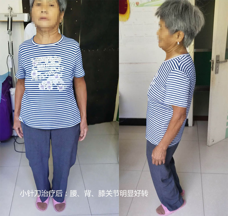 治疗后2.jpg